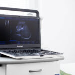 Портативен ехограф Sono Scape работен режим
